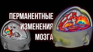 ПСИХОДЕЛИКИ ч3 Изменения в мозге и личности применение в медицине [upl. by Atahs]