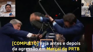 🔥 Completo Veja antes e depois da agressão em Pablo Marçal  Hospitalizado 🔥 [upl. by Elleinahc]