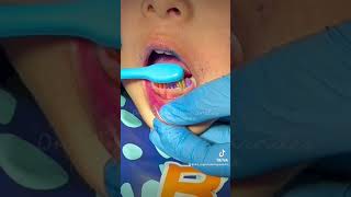 CEPILLADO DENTAL EN NIÑOS Y BEBÉS [upl. by Dimitri562]