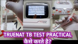 TrueNat TB Test by RTPCR  TrueNat Analyzer मे TB का Test कैसे करते है Practical Video [upl. by Albarran]