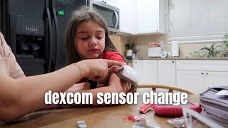 Dexcom CGM sensor change [upl. by Atrebor]