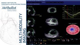 Principles of Echo Doppler William A Zoghbi MD September 18 2018 [upl. by Jordans]