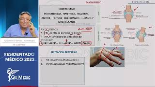 Reumatología  6 Artritis Reumatoide AR [upl. by Lacram]