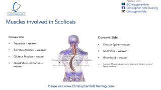 Scoliosis Treatment How to use massage [upl. by Adnael]