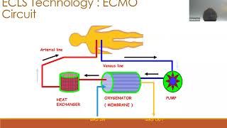 03 ECMO  Physiology by Dr Pranay Oza ECMO INDIA OCT 2024  Day 01 [upl. by Susej]