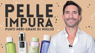 PELLE IMPURA PUNTI NERI E GRANI DI MIGLIO [upl. by Uriia365]