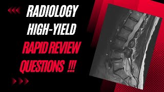 Radiology High Yield Info For Physician Assistant Students [upl. by Forest164]