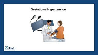 Gestational Hypertension [upl. by Gunas]