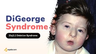 DiGeorge Syndrome Pathophysiology  2Minute Neurology Video  VLearning™ [upl. by Anauqat]