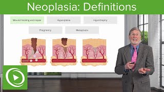 Neoplasia Definitions [upl. by Orlando355]