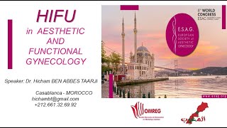 HIFU in gynecology ESAG 2024 at istanbul [upl. by Elata]