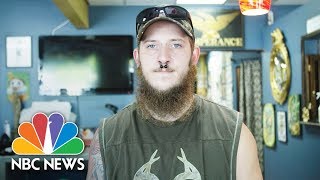 Former Skinhead Seeks Redemption By Covering Hateful Tattoos For Free  NBC News [upl. by Jesselyn]