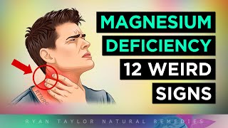 12 Strange Signs Your Body NEEDS Magnesium [upl. by Ettigdirb]