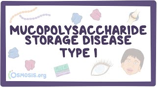 Mucopolysaccharide Storage Disease Type I Hurler HurlerScheie and Scheie syndromes [upl. by Enitsenre9]