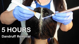 ASMR  5 HOURS  Scalp Check with Bad Results amp Dandruff Treatment Whispered [upl. by Eydie]