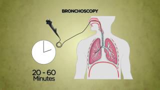 Bronchoscopy [upl. by Yelha397]