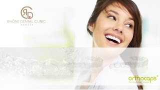 Rhône Dental Clinic quot Orthodontie Invisible quot [upl. by Reede]