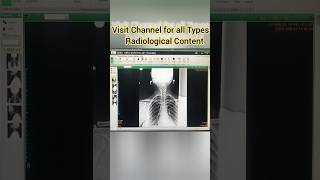 Master Tutorial Fujifilm FCR System xray radiology ct trending viralshorts shorts doctorneet [upl. by Hoag]