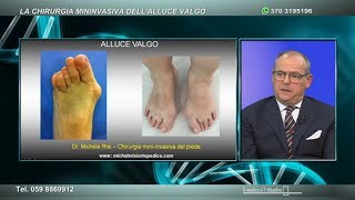 Il Piede e la chirurgia mininvasiva dellalluce valgo [upl. by Leiuqese219]