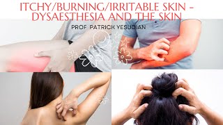 IrritableItchyBurning skin  Dysaesthesia and the skin [upl. by Irby]