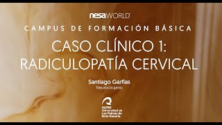 Caso clínico con NESA® Radiculopatía cervical Dr Santiago Garfias neurocirujano Ft NESA WORLD® [upl. by Ahsikal583]