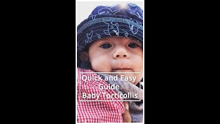 5 Signs Your Baby May Have Torticollis Quick And Easy Guide [upl. by Wahlstrom650]