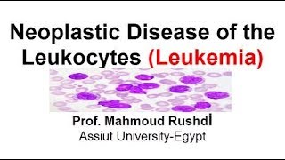 Neoplastic Disease of the Leukocytes  Leukemia Arabic Lecture [upl. by Urban]