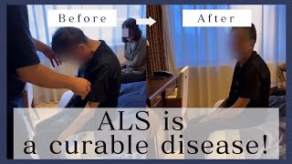 ALS patient can change his symptom on the spot [upl. by Consuela405]