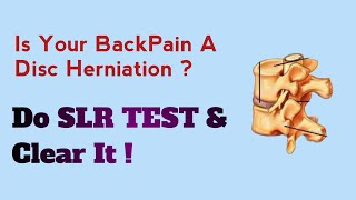 How To Perform SLR Test For Disc Slip  BackPain Treatment  Sciatica [upl. by Ttocs]