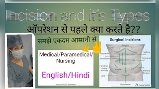 Incision and its Types। Its uses and location।Medical । Paramedical।NursingGNM  Bsc nursing [upl. by Jenine]