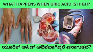 HIGH URIC ACID CAN DAMAGE YOUR HEARTLIVER KIDNEY AND BRAININCREASED SERUM URIC ACID IN KANNADA [upl. by Hak563]