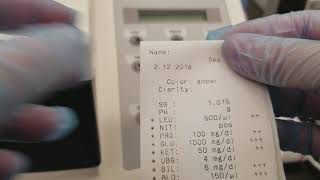 Urinalysis Replacing the printer paper on the Criterion II and QC troubleshooting [upl. by Liw228]