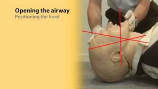 Basic Airway Management 1 [upl. by Talbert758]