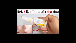 Melacare Cream Review in Hindi मेलाकेयर क्रीम के फायदे नुकसान उपयोग [upl. by Attegroeg]