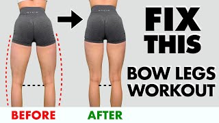 10 Min quotBow Legsquot Home Workout  FIX Bow Legs in 10 MinDay [upl. by Dahlstrom]