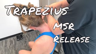 Trapezius Muscle Release  MSR Procedures [upl. by Witherspoon847]