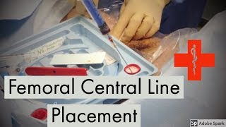 Femoral Central Line Placement [upl. by Ullyot]