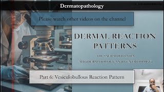 Dermatopathology  VI  Vesiculobullous Reaction Pattern [upl. by Anissej504]