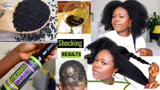 4 Ways to Use Pure Black Seed Oil For Massive hair Growth and For over all Health [upl. by Amara]