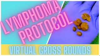 VGR  Lymphoma Protocol [upl. by Isman]