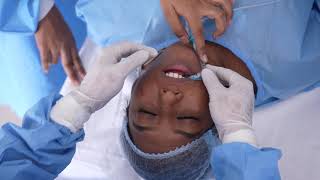 Full Anesthesia Procedure Before Plastic Surgery [upl. by Kreda388]