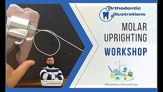 ep 25  orthodontic molar uprighting mechanics  wire bending workshop [upl. by Hassi]