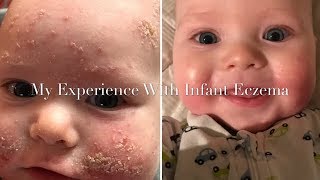 Infant Eczema  My Babys Experience [upl. by Kentigerma877]