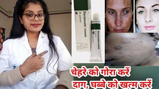 Dermovate CreamDermovate cream honest reviewDermovate cream benefits uses amp side effects in hindi [upl. by Ikram]