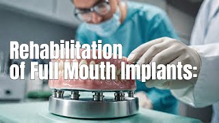 Rehabilitation of Full Mouth Implants A Case Study  Laguna Hills dental implants [upl. by Arrimat]