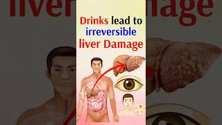 Drinks lead to irreversible liver damage [upl. by Aeniah160]