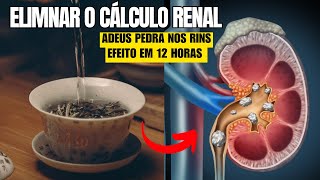 Como Eliminar Pedras Da Vesícula CALCULO RENAL Naturalmente Em Casa [upl. by Mozes290]