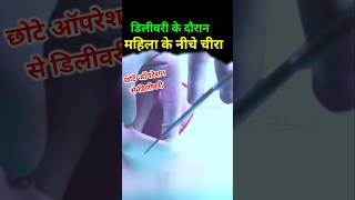 Normal delivery में छोटा ऑपरेशन chotaoperation episiotomy [upl. by Ginsberg]