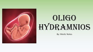 OampG Oligohydramnios  causes investigations management complications [upl. by Daahsar]