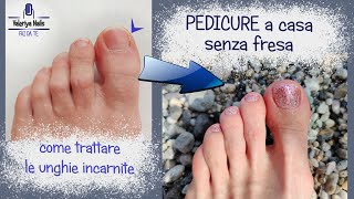 Pedicure fai da te SENZA FRESA  Come trattare la unghia incarnita a casa [upl. by Euk]